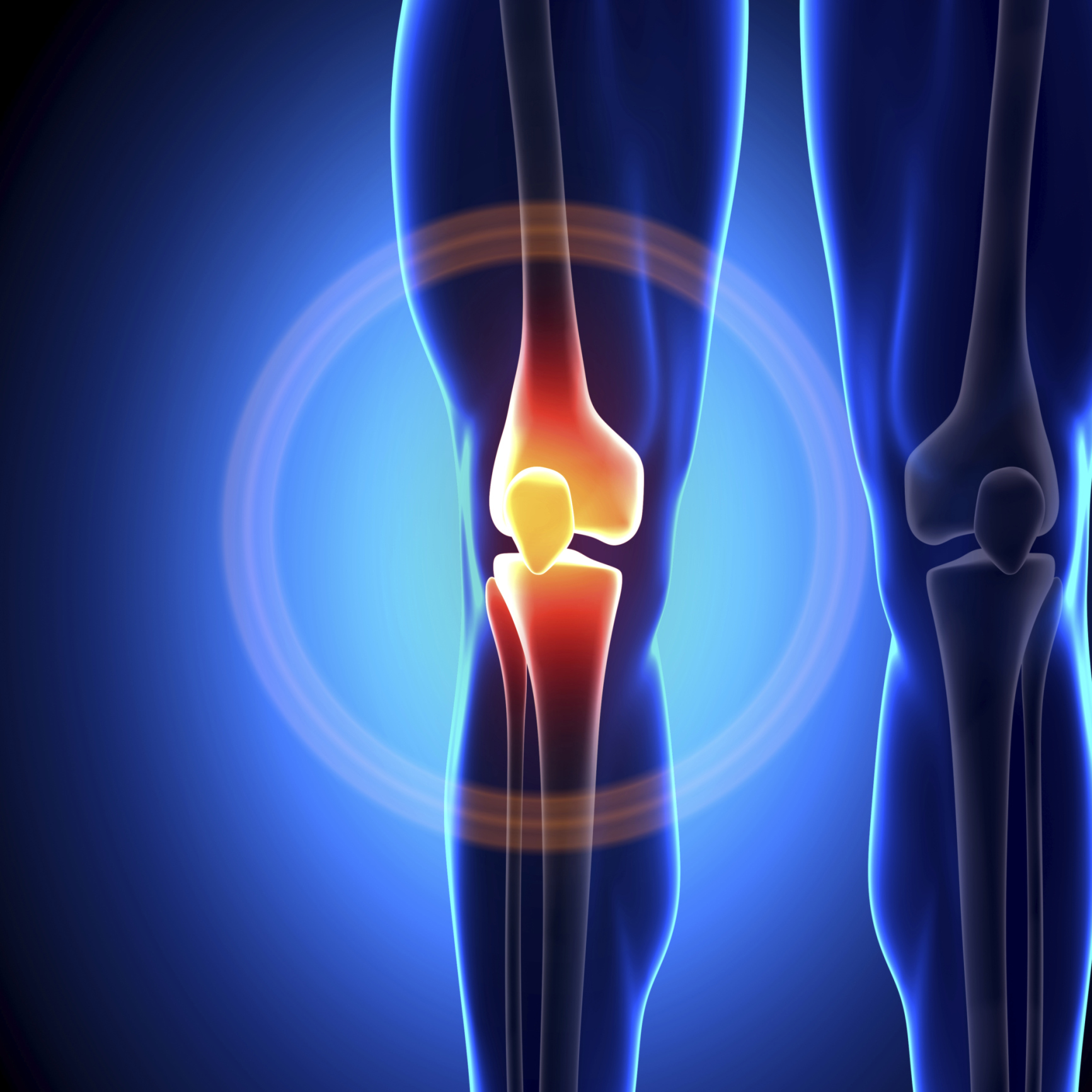 Knee Bursitis Tendonitis Pain