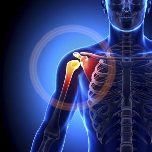 Osteoarthritis of Shoulder - Ours