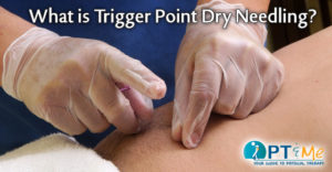 dry needling physical therapist
