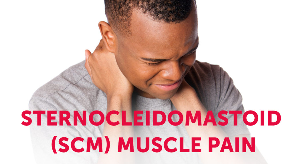 Sternocleidomastoid (SCM) Muscle Pain