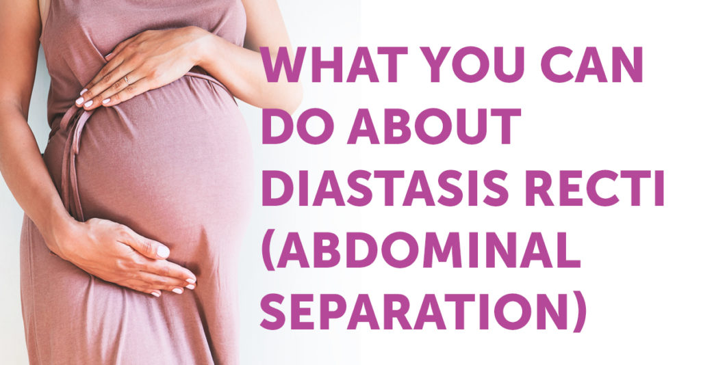 What You Can Do About Diastis Recti (Abdominal Separation) - PT & ME