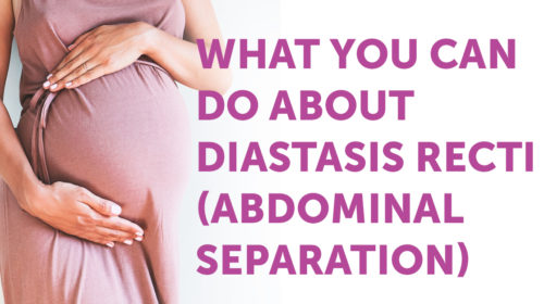 diastasis recti abdominal separation