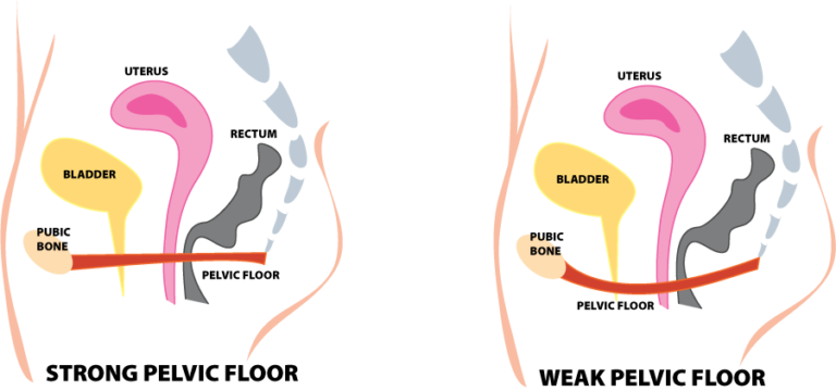 Womens Health Physical Therapy Pelvic Health Ptandme