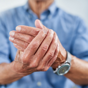 physical therapy for arthritis