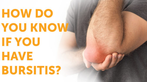 How Do You Know if you have Bursitis